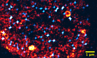 Abbildung: Arbeitsgruppen Nienhaus und Hilbert, KIT Microscopy of a nucleus: Transcription factories are colored orange, activated genes light blue.